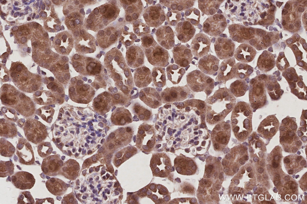 Immunohistochemistry (IHC) staining of mouse kidney tissue using FZR1/Cdh1 Polyclonal antibody (16368-1-AP)