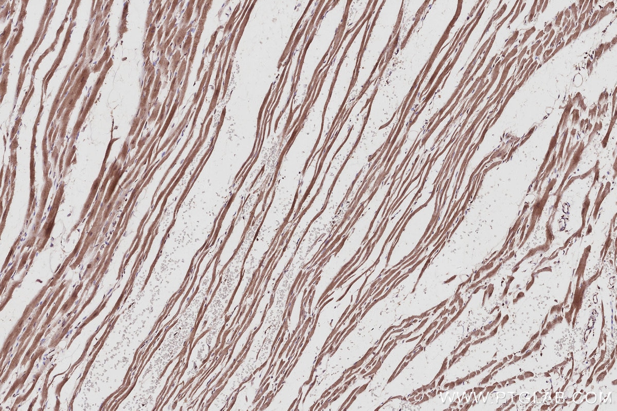 Immunohistochemistry (IHC) staining of rat heart tissue using FZR1/Cdh1 Polyclonal antibody (16368-1-AP)