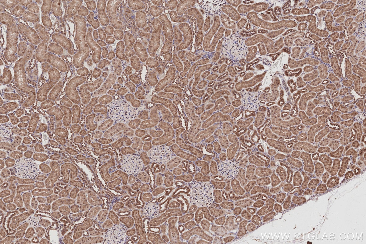 Immunohistochemistry (IHC) staining of rat kidney tissue using FZR1/Cdh1 Polyclonal antibody (16368-1-AP)