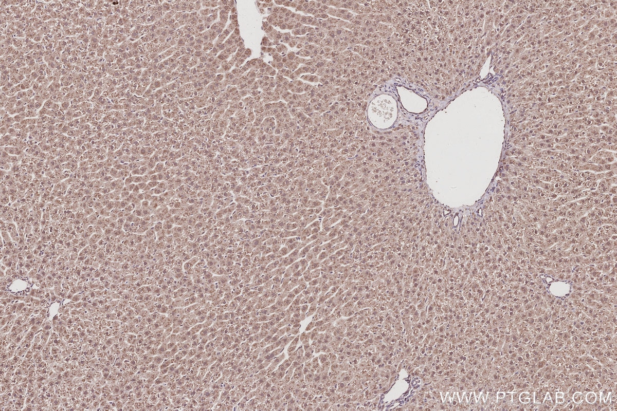 Immunohistochemistry (IHC) staining of rat liver tissue using FZR1/Cdh1 Polyclonal antibody (16368-1-AP)