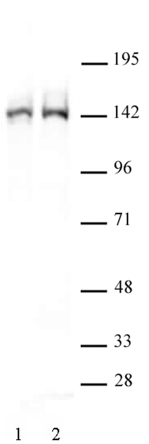 Western blot of FancD2 antibody. Lane 1: HeLa whole-cell extract (40 ug). Lane 2: Nuclear extract (40 ug) of K-562 cells. Both probed with FancD2 antibody (pAb) at a 1:500 dilution.