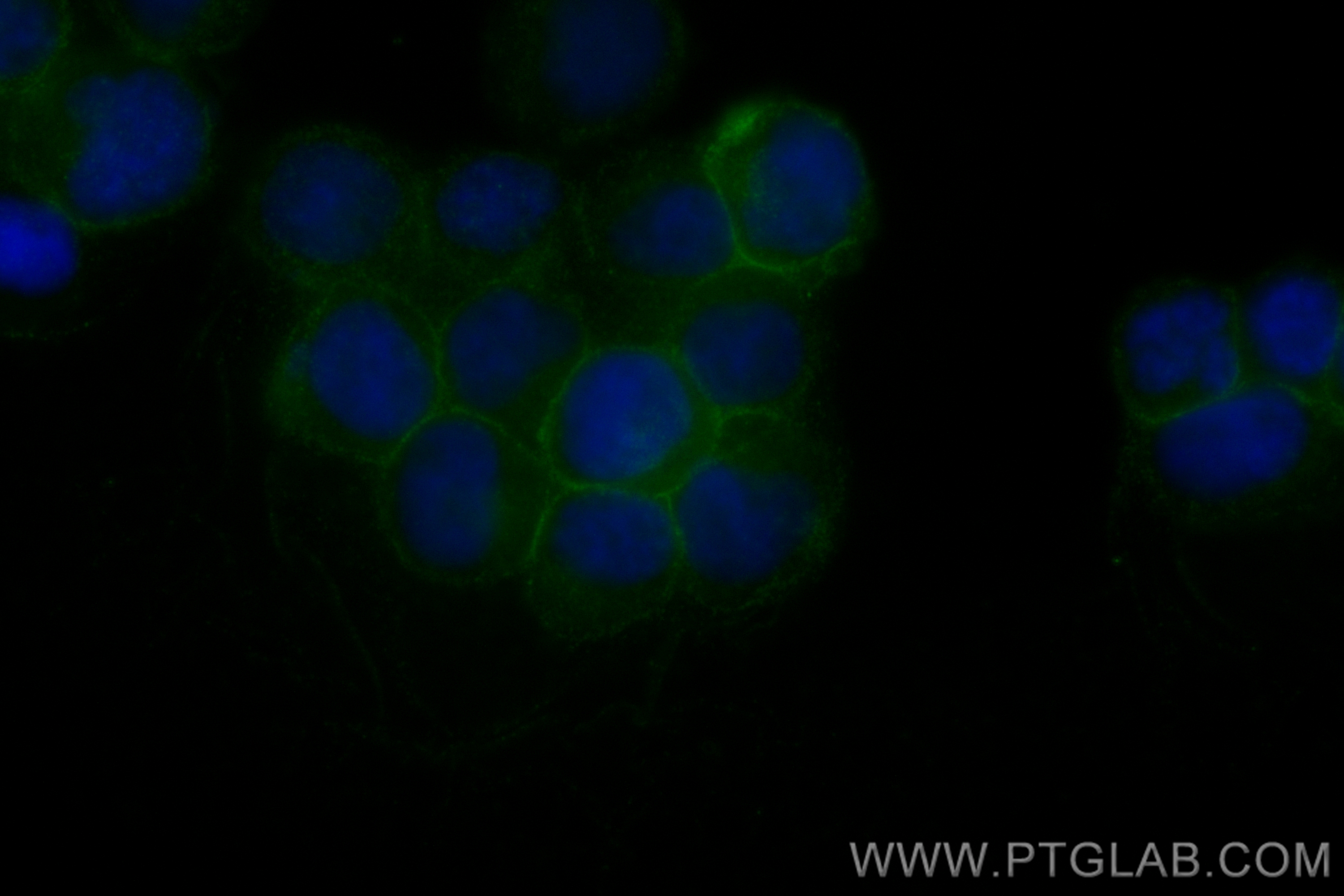 Immunofluorescence (IF) / fluorescent staining of Jurkat cells using CoraLite® Plus 488-conjugated Fas/CD95 Recombinant (CL488-83400-5)