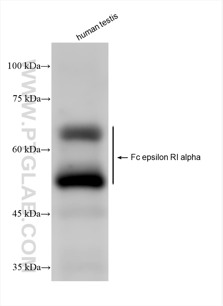 Western Blot (WB) analysis of various lysates using Fc epsilon RI alpha Recombinant antibody (84662-3-RR)