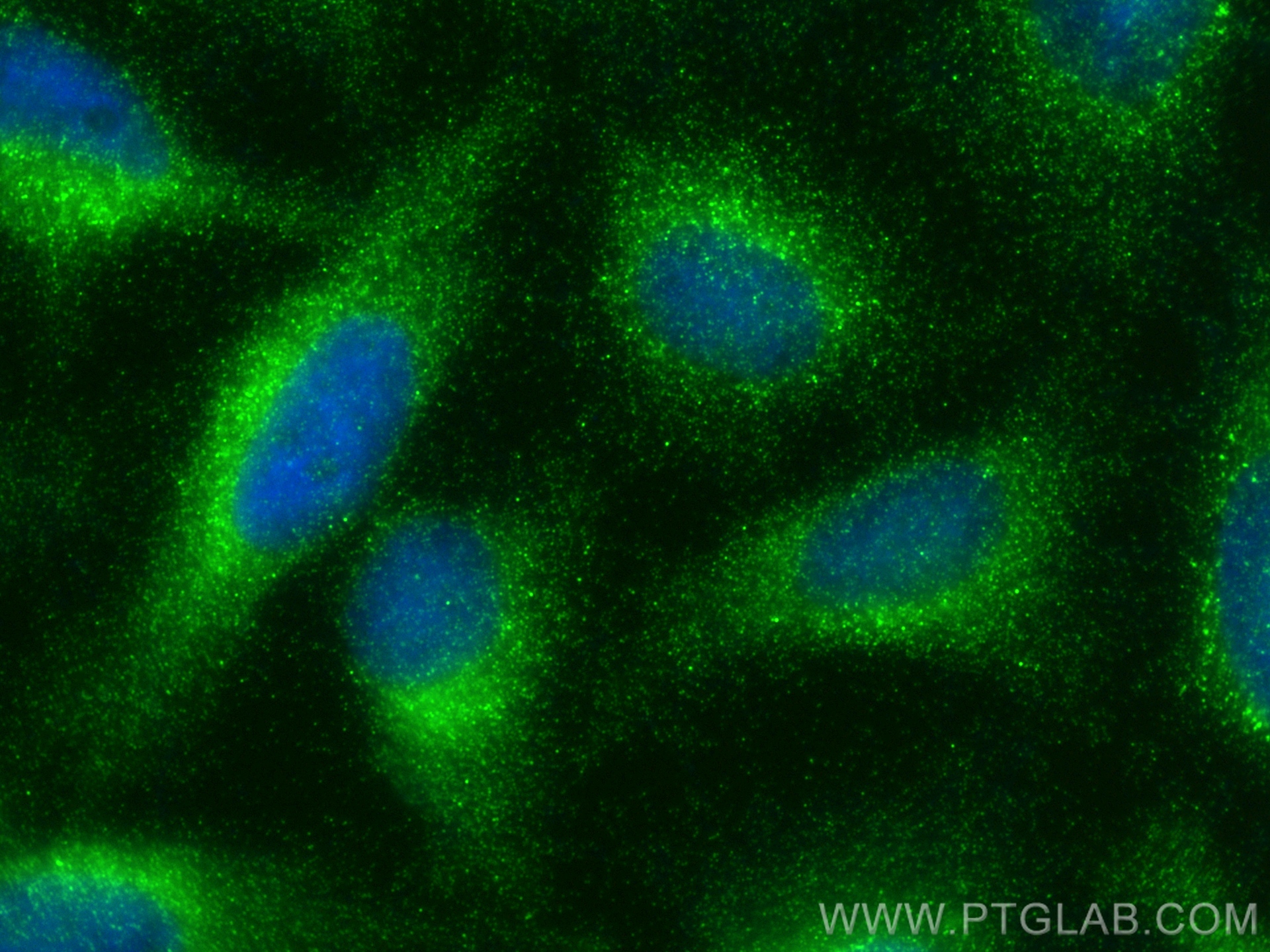 Immunofluorescence (IF) / fluorescent staining of HeLa cells using Ferritin heavy chain Recombinant antibody (83428-1-RR)