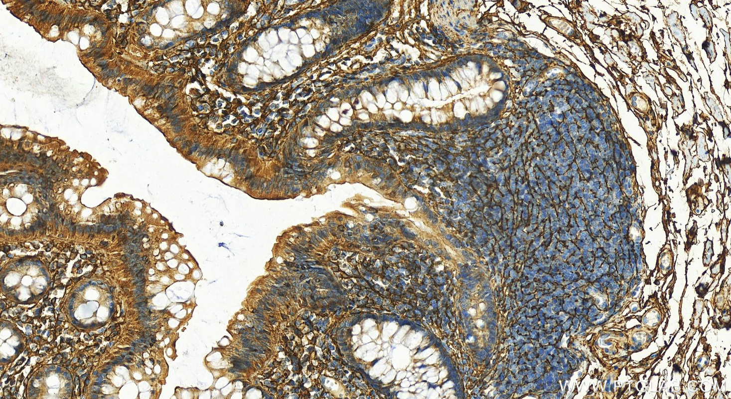 Immunohistochemistry (IHC) staining of human normal colon using Fibrillin 1 Polyclonal antibody (29425-1-AP)