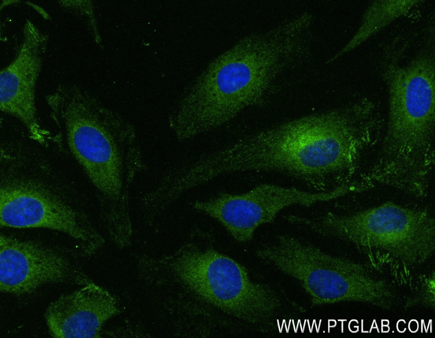 Immunofluorescence (IF) / fluorescent staining of HeLa cells using Fibrillin 1  Recombinant antibody (83836-2-RR)