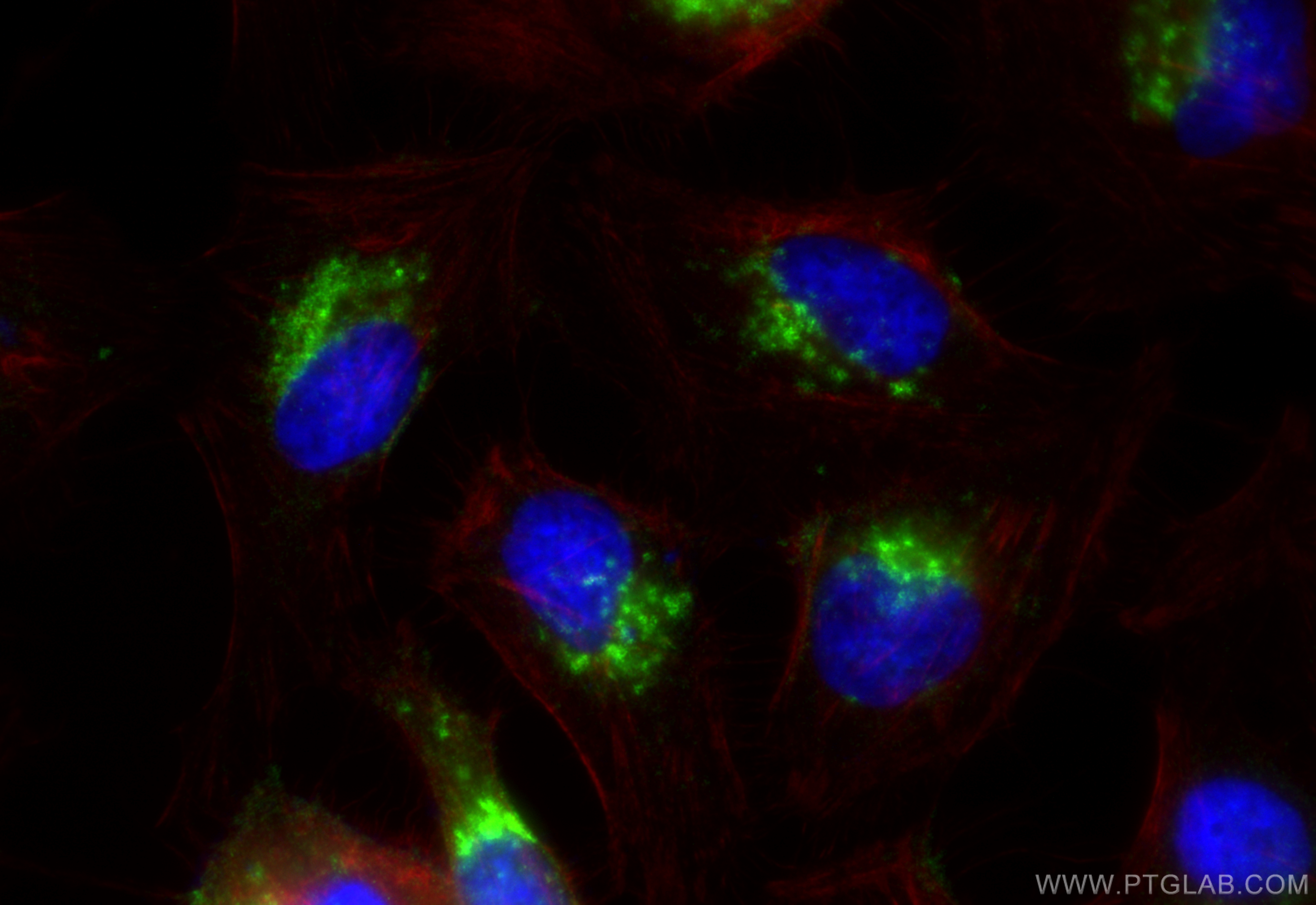 Immunofluorescence (IF) / fluorescent staining of HeLa cells using Flotillin 1 Recombinant antibody (83598-4-RR)