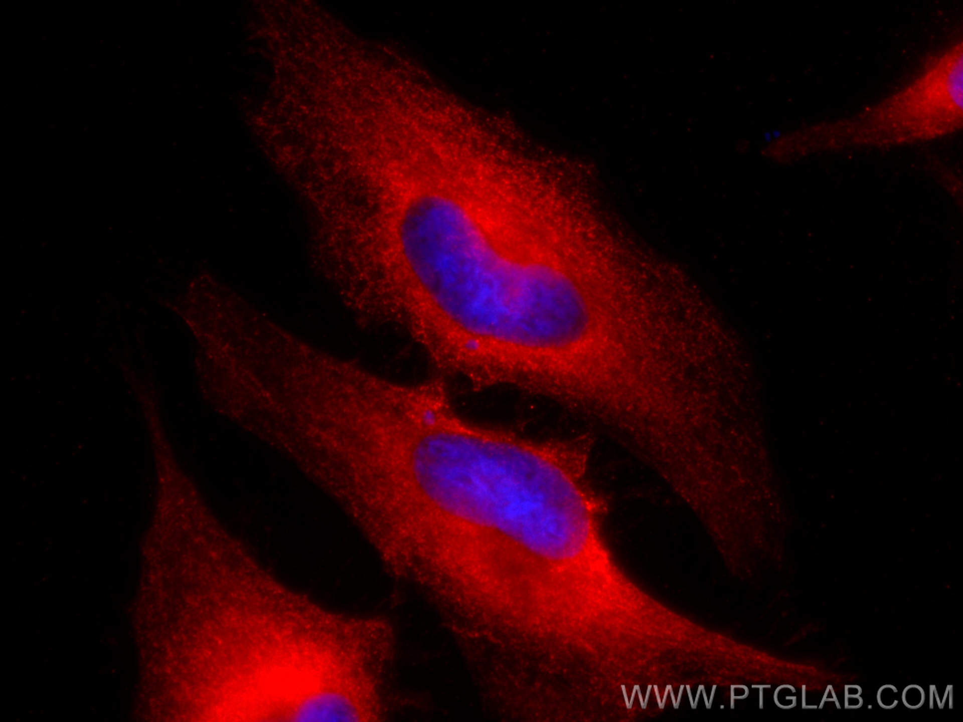 Immunofluorescence (IF) / fluorescent staining of HeLa cells using CoraLite®594-conjugated Follistatin Monoclonal ant (CL594-60060)