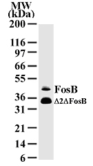 FosB mAb tested by Western blot. Detection of FosB by Western blot. The analysis was performed using HeLa nuclear extract and FosB mAb. A protein of approximate MW of 46 kDa was detected. The lower MW protein detected at 34 kDa may be the isoform of D2D FosB.