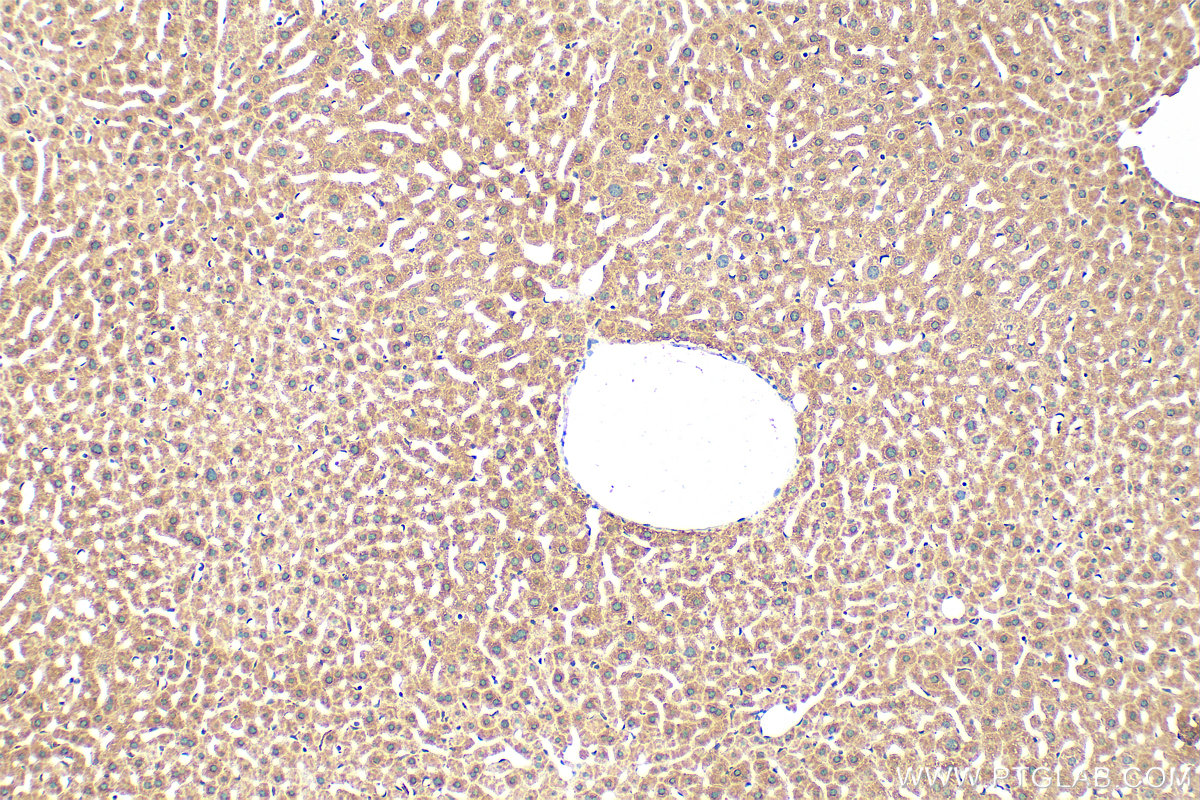 Immunohistochemistry (IHC) staining of mouse liver tissue using G0S2 Polyclonal antibody (12091-1-AP)