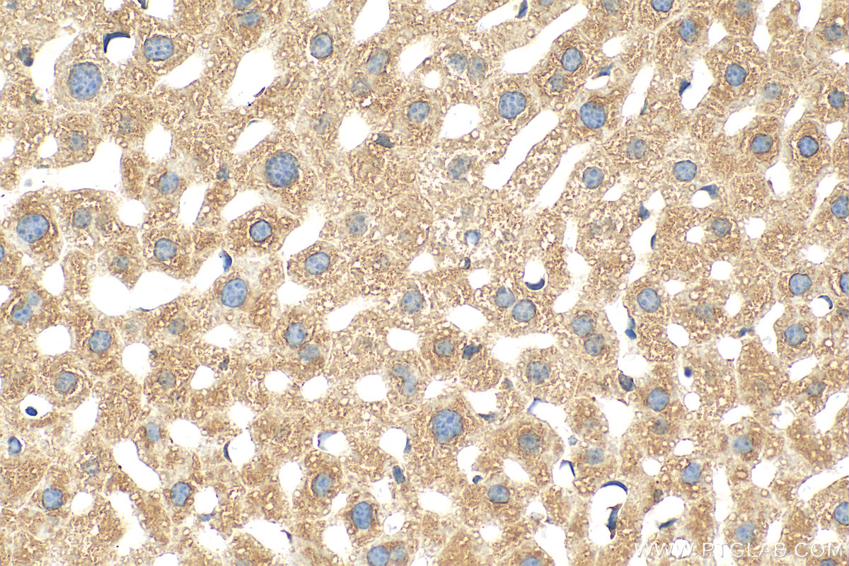 Immunohistochemistry (IHC) staining of mouse liver tissue using G0S2 Polyclonal antibody (12091-1-AP)