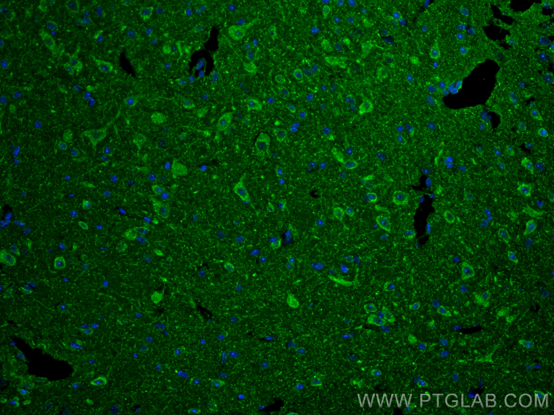 Immunofluorescence (IF) / fluorescent staining of mouse brain tissue using G3BP1 Recombinant antibody (80777-1-RR)