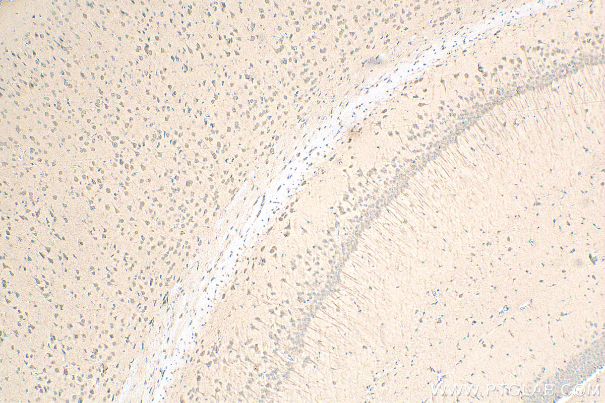 Immunohistochemistry (IHC) staining of mouse brain tissue using G3BP1 Recombinant antibody (80777-1-RR)