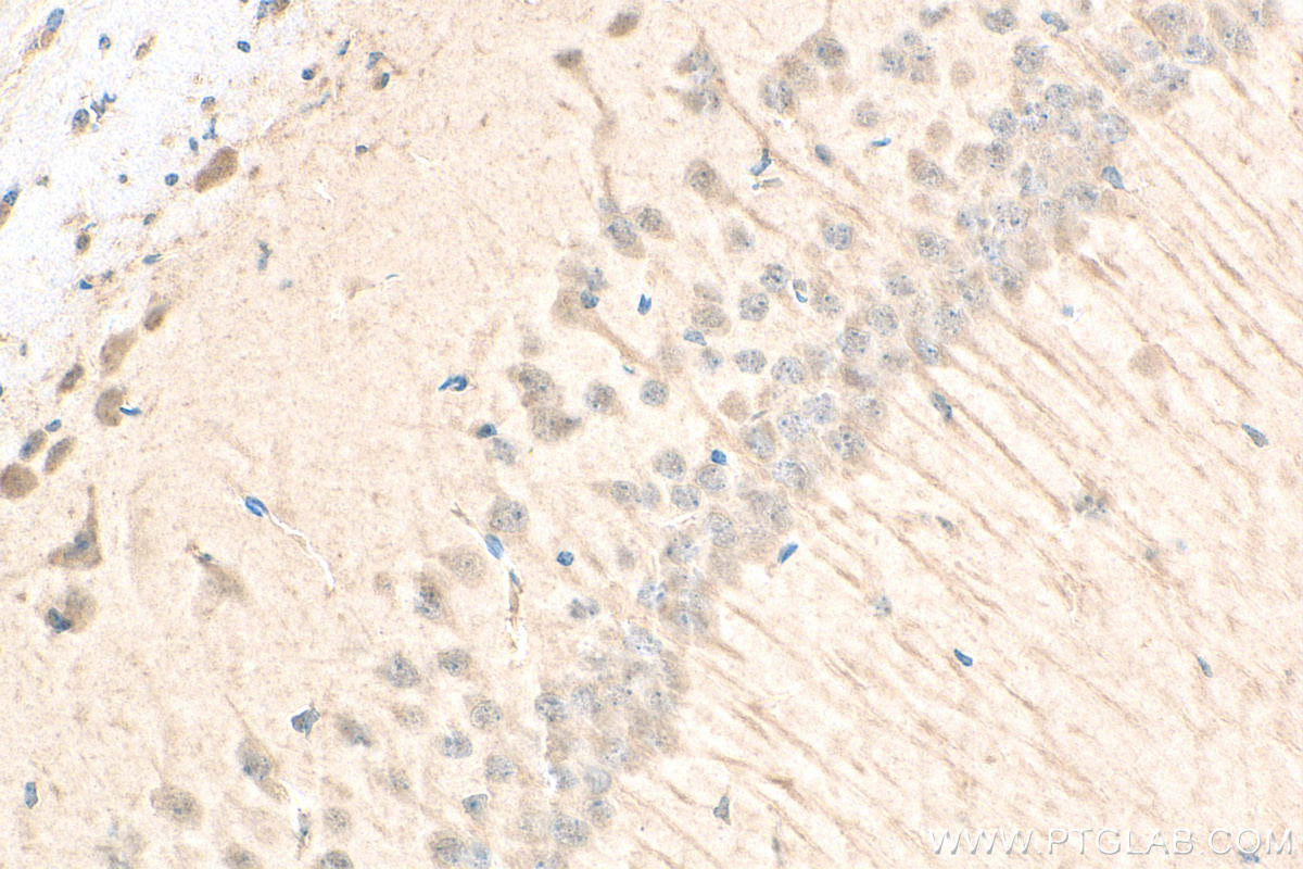 Immunohistochemistry (IHC) staining of mouse brain tissue using G3BP1 Recombinant antibody (80777-1-RR)