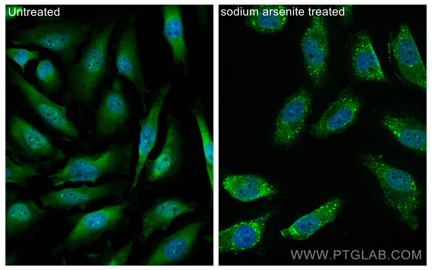 Immunofluorescence (IF) / fluorescent staining of HeLa cells using CoraLite® Plus 488-conjugated G3BP2 Recombinant an (CL488-82080-4)