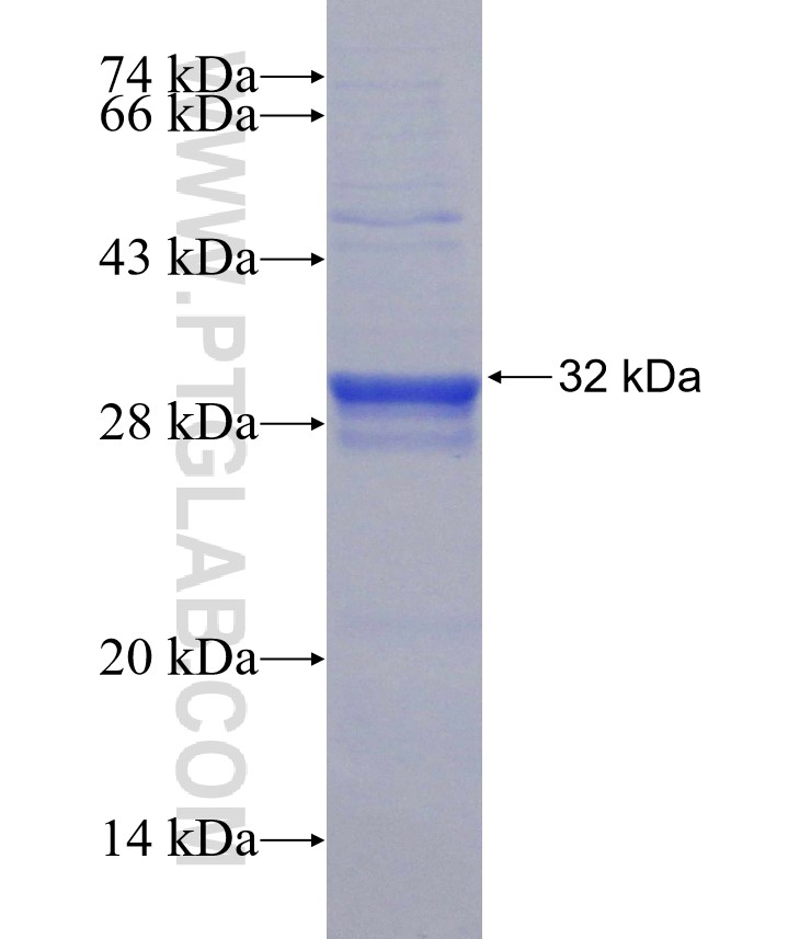 G6PC fusion protein Ag30614 SDS-PAGE