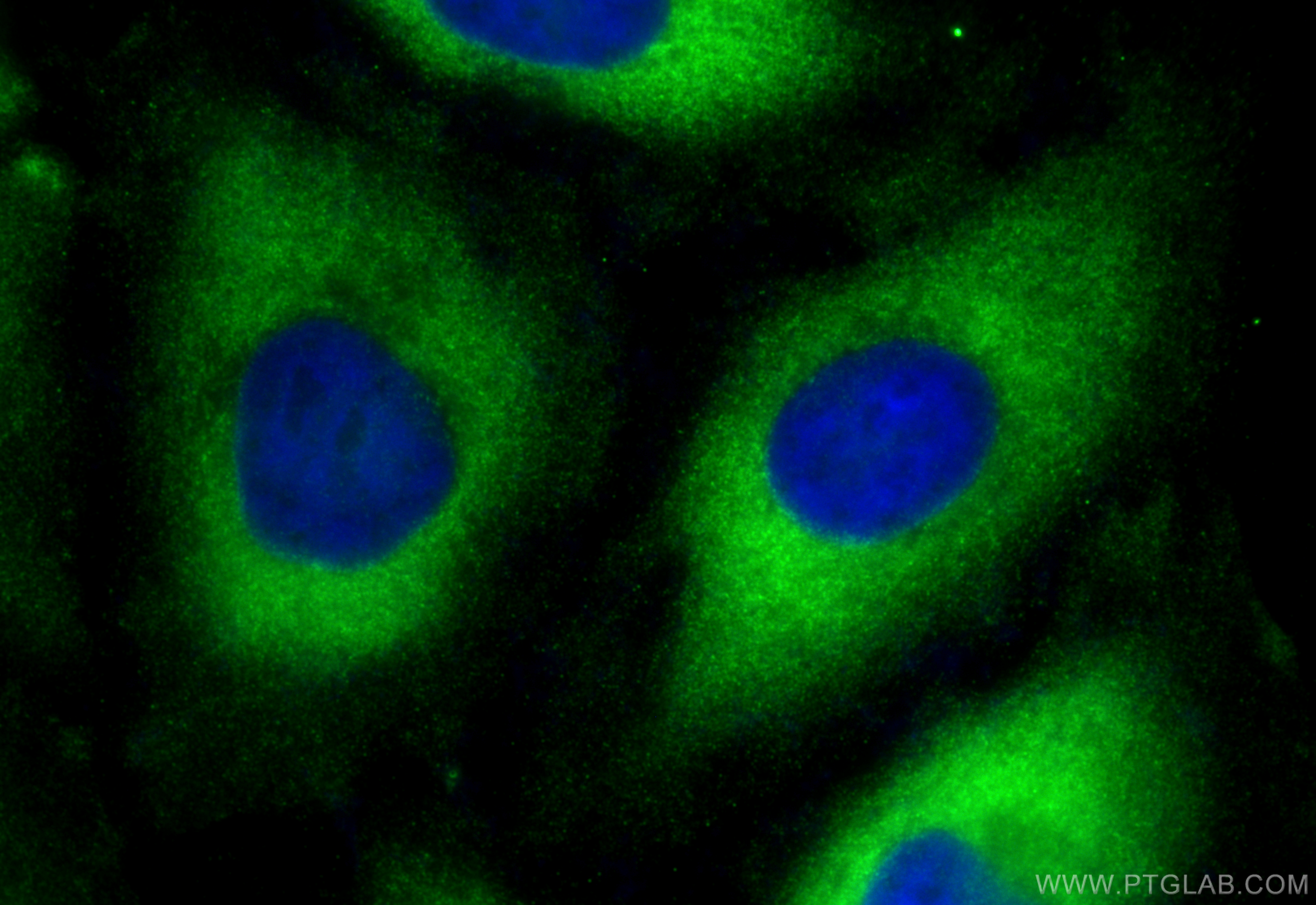 Immunofluorescence (IF) / fluorescent staining of HeLa cells using G6PD Polyclonal antibody (25413-1-AP)