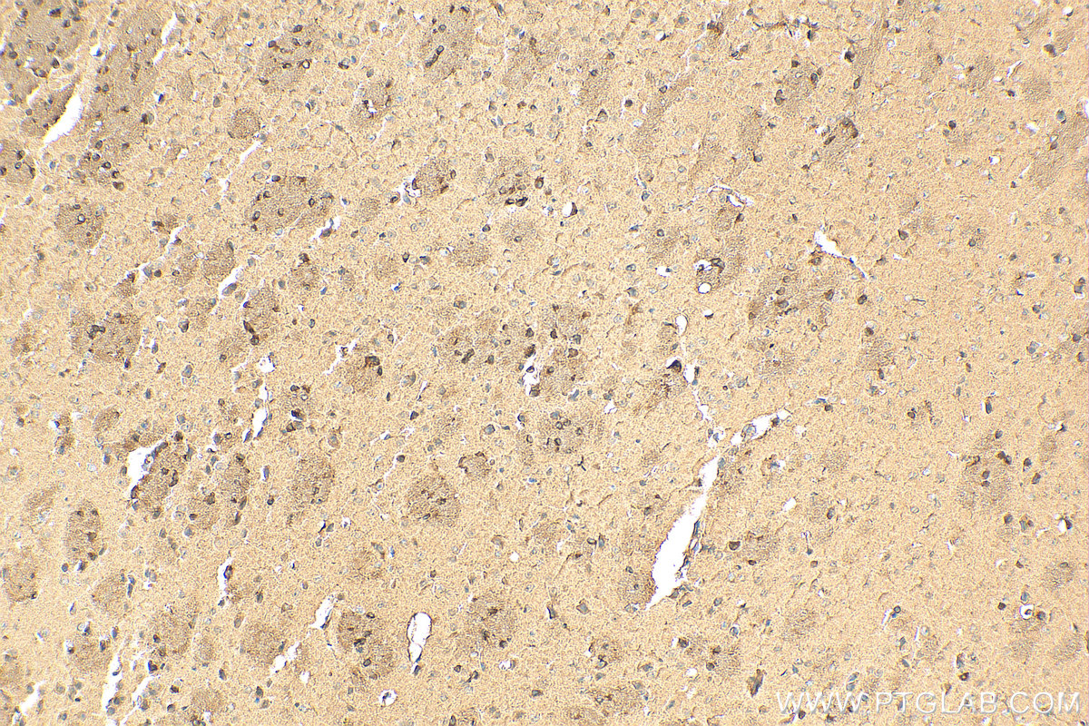 Immunohistochemistry (IHC) staining of mouse brain tissue using GAB1 Polyclonal antibody (26200-1-AP)