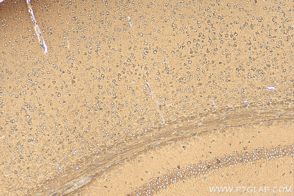 Immunohistochemistry (IHC) staining of mouse brain tissue using GABARAP Polyclonal antibody (18723-1-AP)