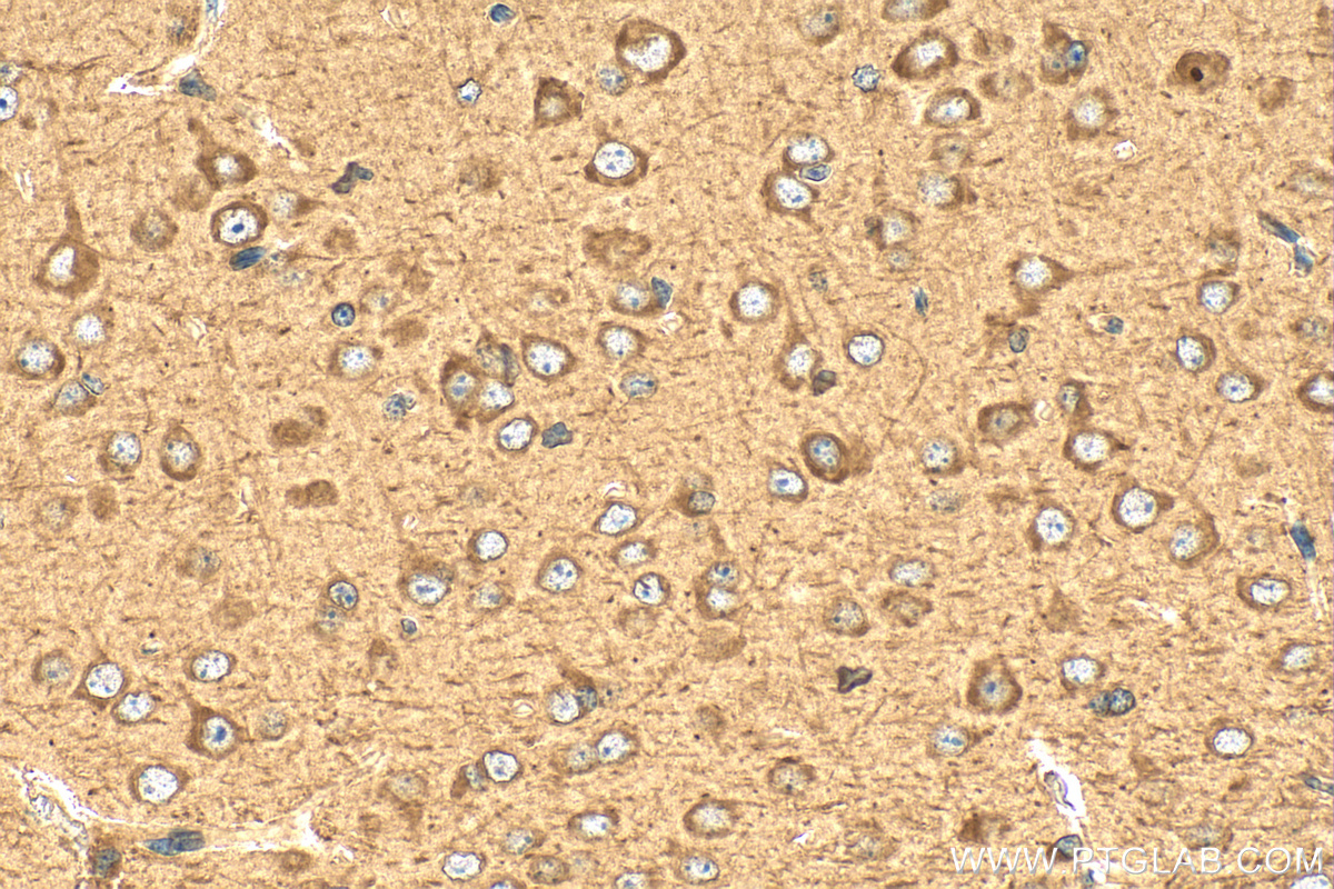 Immunohistochemistry (IHC) staining of mouse brain tissue using GABARAP Polyclonal antibody (18723-1-AP)