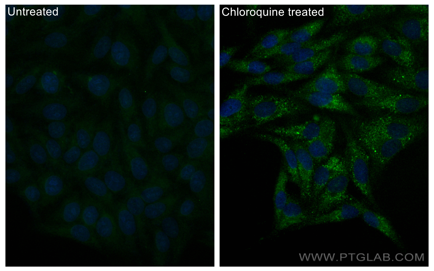 Immunofluorescence (IF) / fluorescent staining of HepG2 cells using CoraLite® Plus 488-conjugated GABARAPL1 Recombinan (CL488-83817)