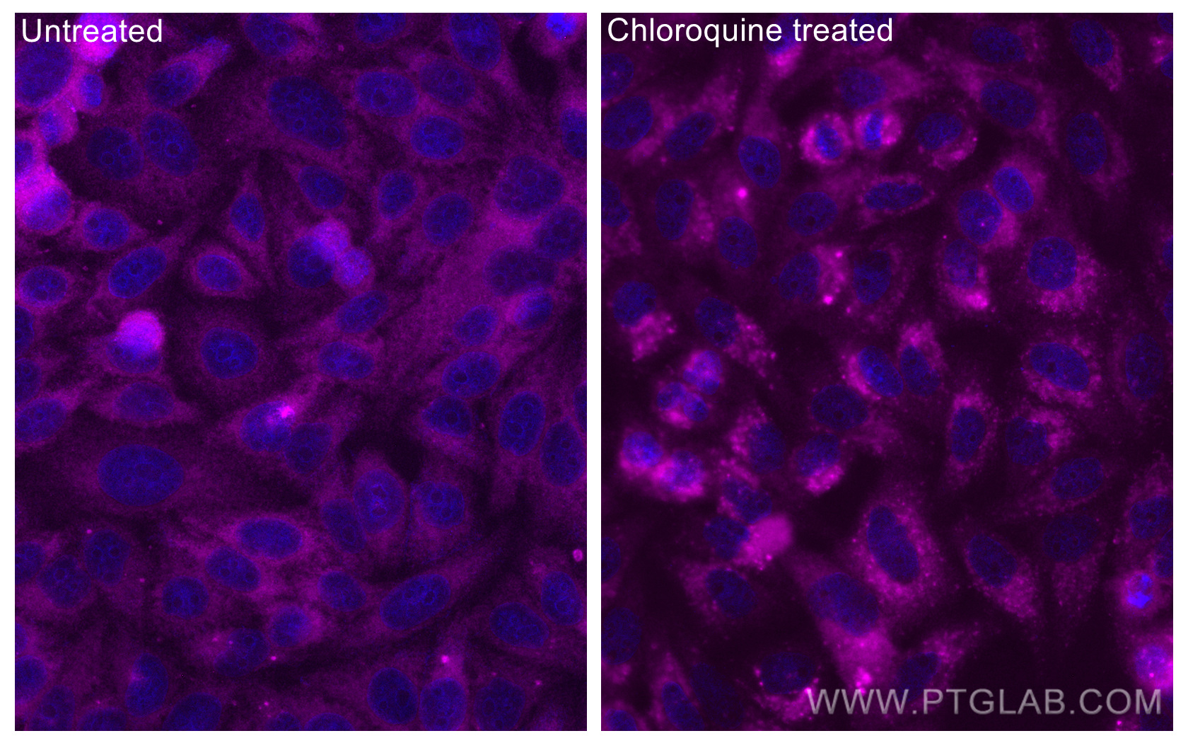 Immunofluorescence (IF) / fluorescent staining of HepG2 cells using CoraLite® Plus 647-conjugated GABARAPL1-Specific P (CL647-11010)