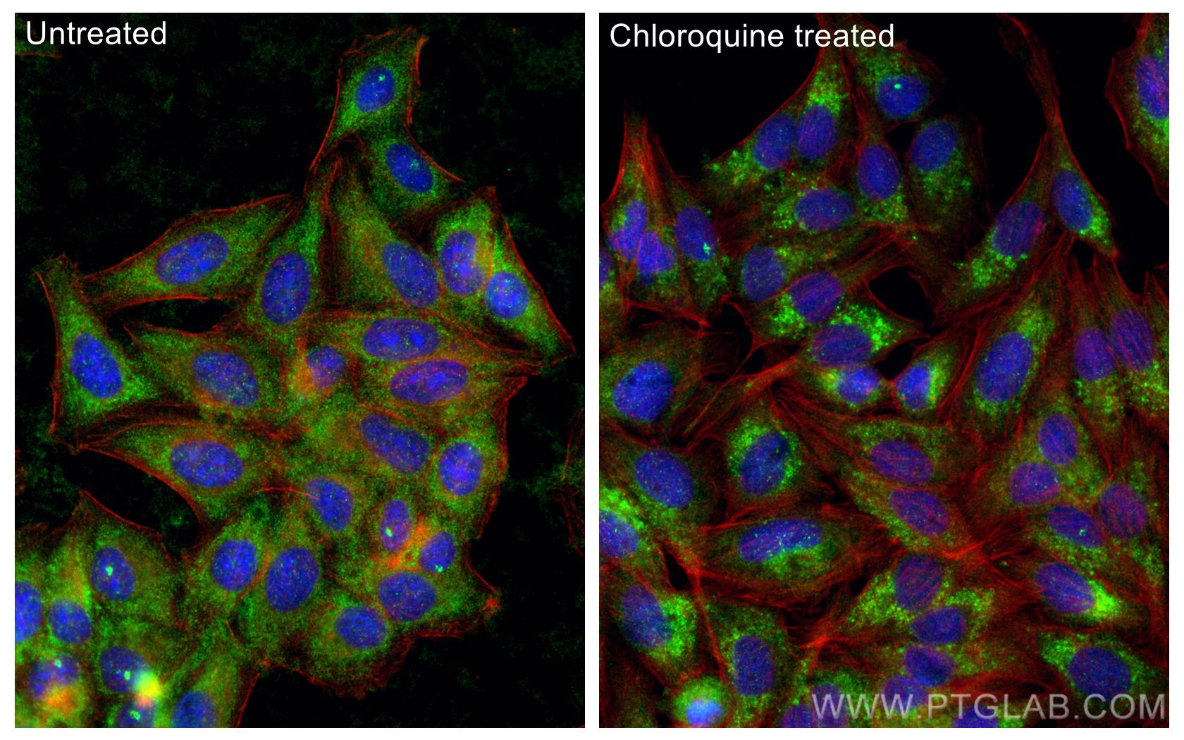 Immunofluorescence (IF) / fluorescent staining of HepG2 cells using GABARAPL2-Specific Polyclonal antibody (18724-1-AP)