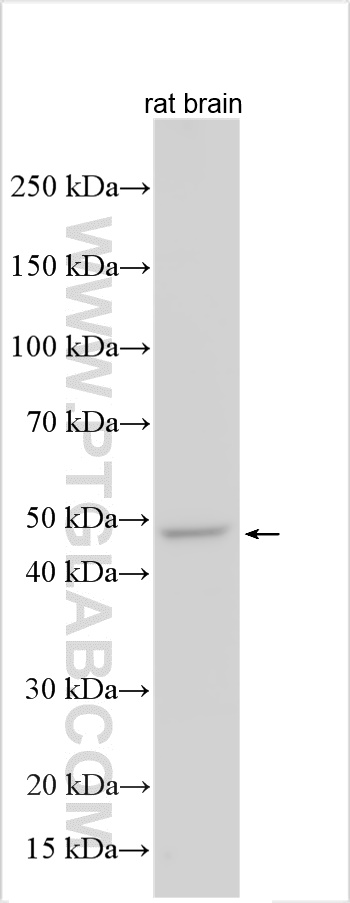 Western Blot (WB) analysis of various lysates using GABRA2 Polyclonal antibody (28535-1-AP)