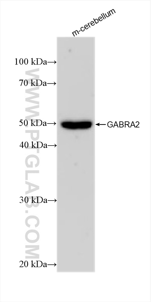 Western Blot (WB) analysis of various lysates using GABRA2 Recombinant antibody (83057-2-RR)