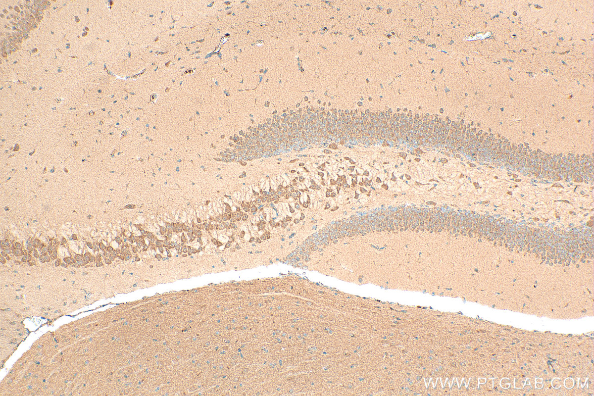 Immunohistochemistry (IHC) staining of mouse brain tissue using GABRA4 Polyclonal antibody (12979-1-AP)