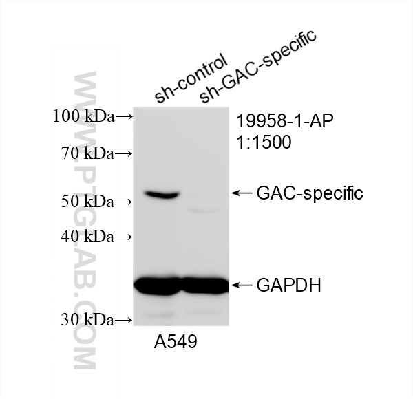 Western Blot (WB) analysis of A549 cells using GAC-specific Polyclonal antibody (19958-1-AP)