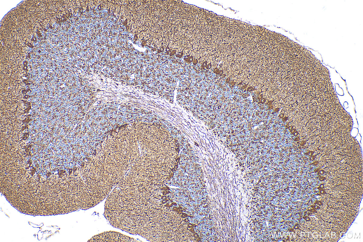 Immunohistochemistry (IHC) staining of mouse cerebellum tissue using GAD1 Polyclonal antibody (10408-1-AP)