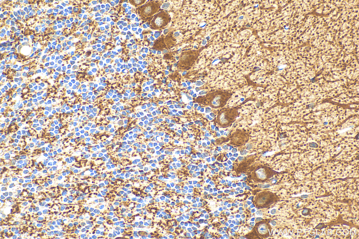 Immunohistochemistry (IHC) staining of mouse cerebellum tissue using GAD1 Polyclonal antibody (10408-1-AP)