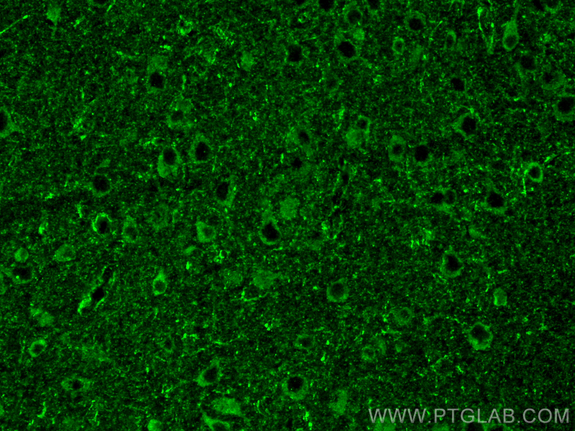 Immunofluorescence (IF) / fluorescent staining of mouse brain tissue using GAD65 Polyclonal antibody (21760-1-AP)