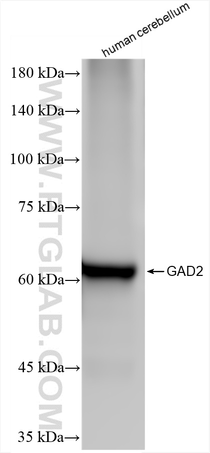 Western Blot (WB) analysis of human cerebellum tissue using GAD65 Recombinant antibody (85750-1-RR)