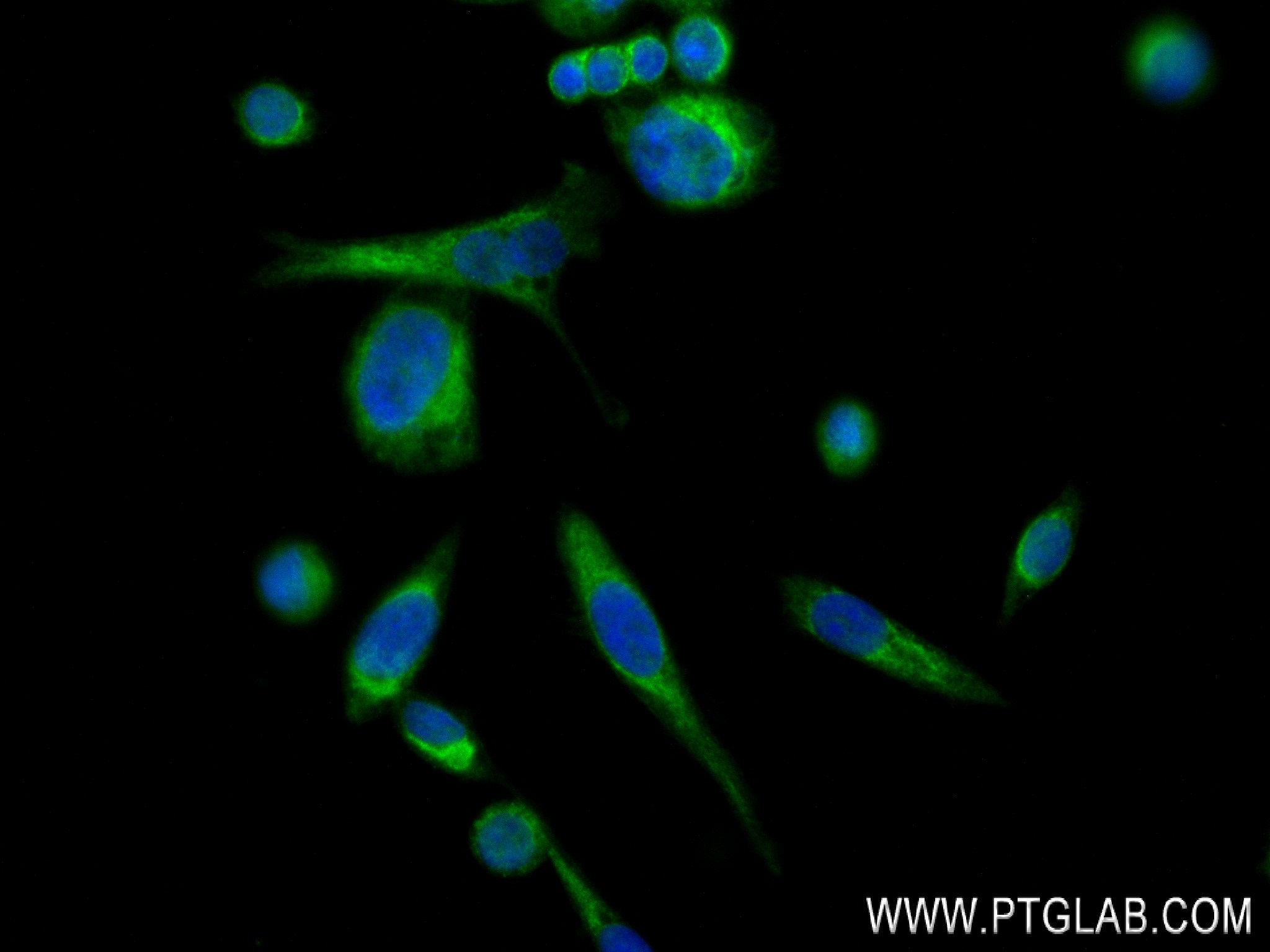 Immunofluorescence (IF) / fluorescent staining of PC-3 cells using GADD34 Recombinant antibody (81250-1-RR)