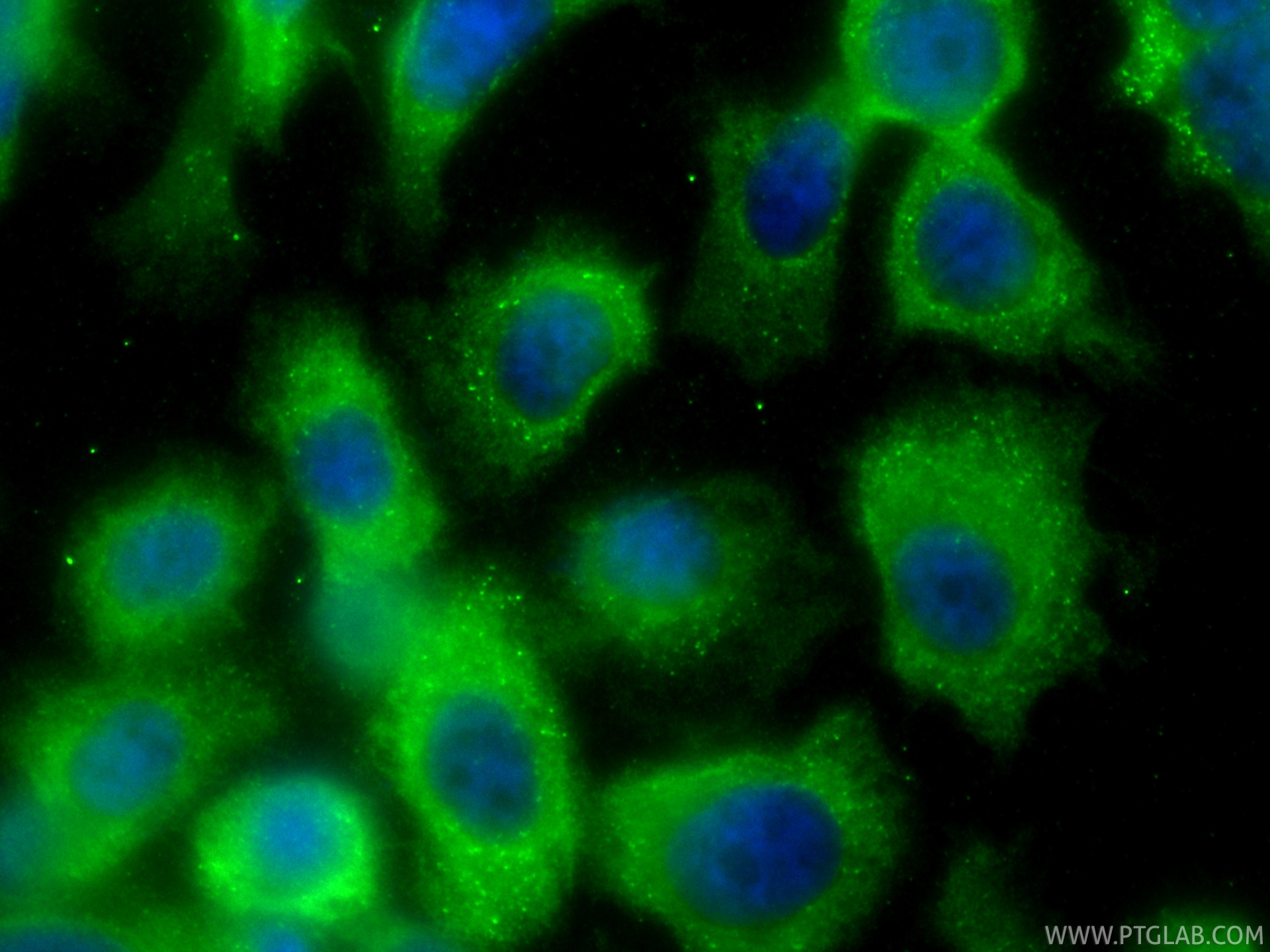 Immunofluorescence (IF) / fluorescent staining of PC-3 cells using CoraLite® Plus 488-conjugated GADD34 Recombinant m (CL488-81250)