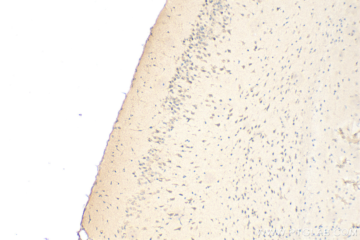 Immunohistochemistry (IHC) staining of mouse brain tissue using GADD45GIP1 Polyclonal antibody (16260-1-AP)