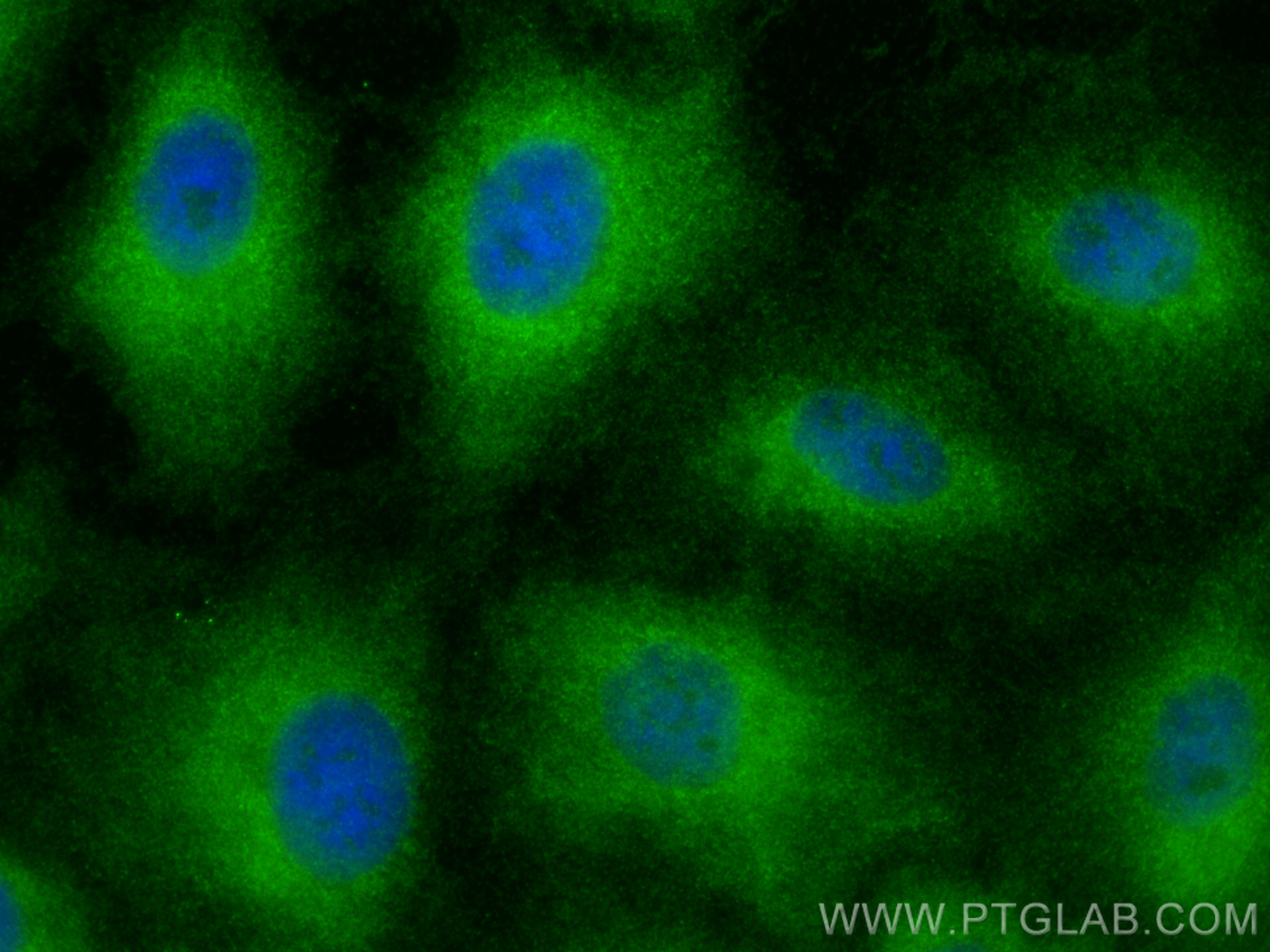 Immunofluorescence (IF) / fluorescent staining of A549 cells using Galectin-1 Polyclonal antibody (11858-1-AP)