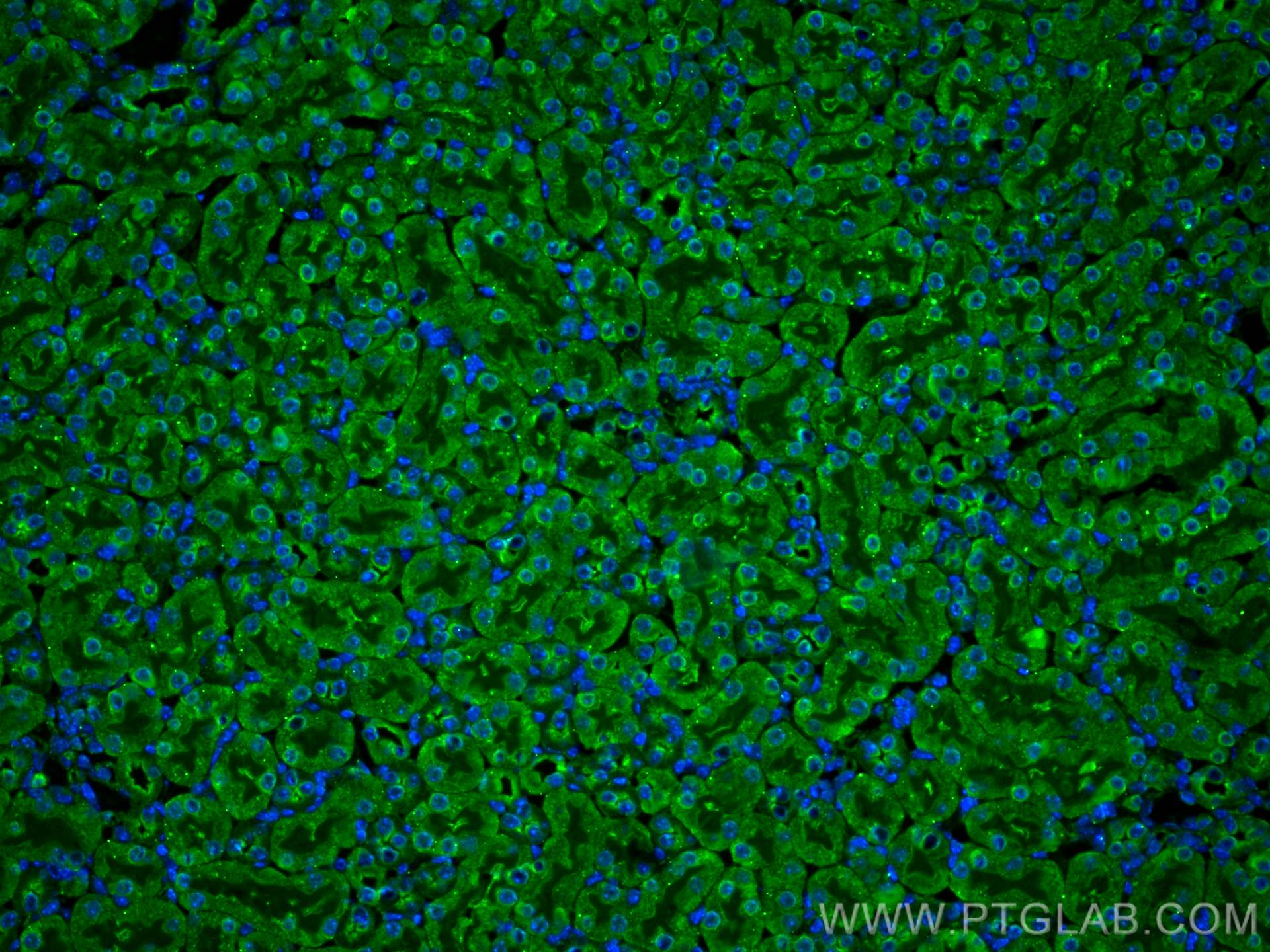 Immunofluorescence (IF) / fluorescent staining of mouse kidney tissue using Galectin-3 Monoclonal antibody (60207-1-Ig)