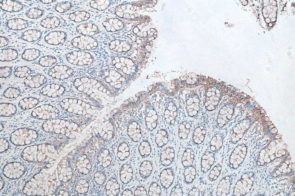 Immunohistochemistry (IHC) staining of human colon tissue using Galectin-3 Monoclonal antibody (60207-1-Ig)