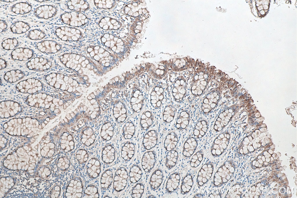 Immunohistochemistry (IHC) staining of human colon tissue using Galectin-3 Monoclonal antibody (60207-1-Ig)