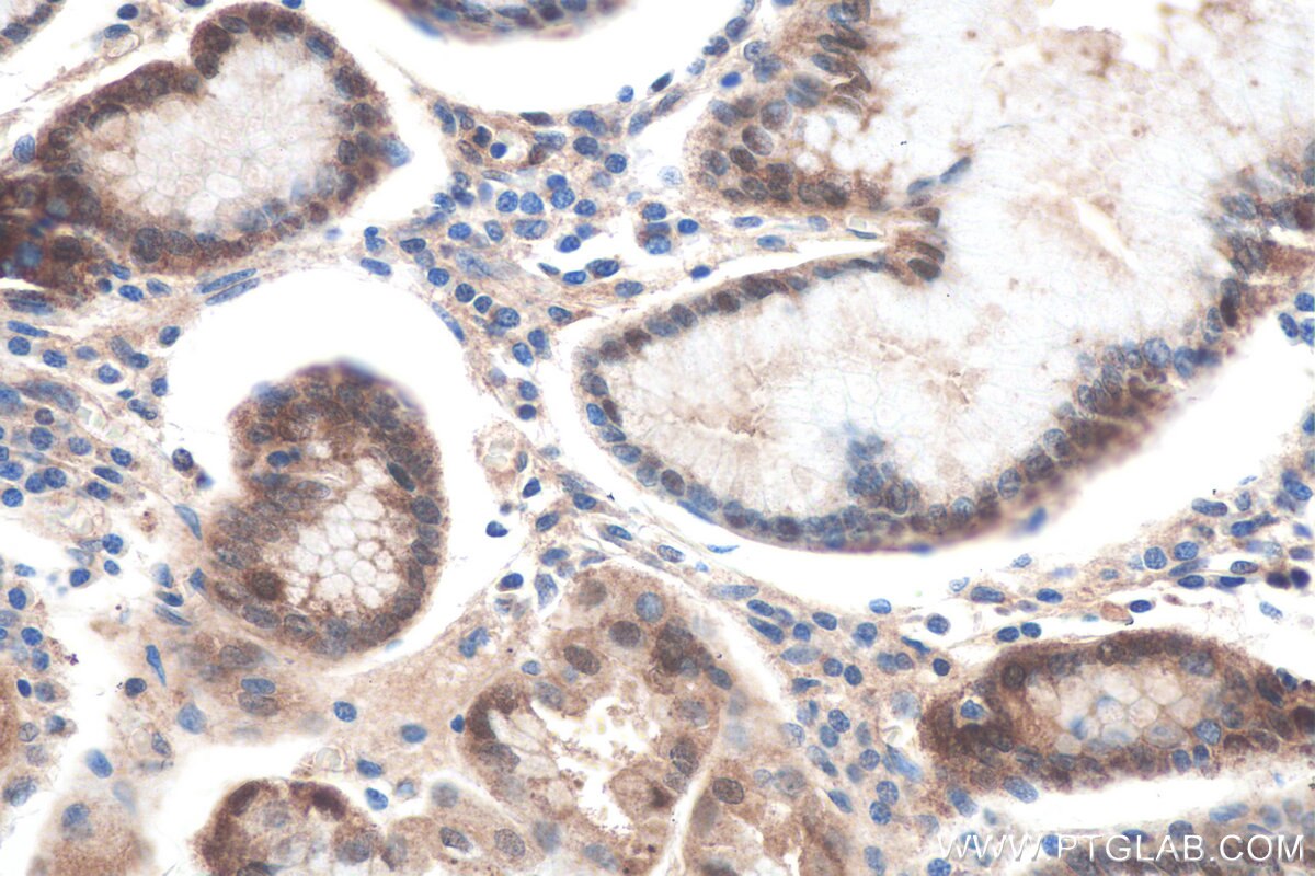 Immunohistochemistry (IHC) staining of human stomach tissue using Galectin-3 Monoclonal antibody (60207-1-Ig)