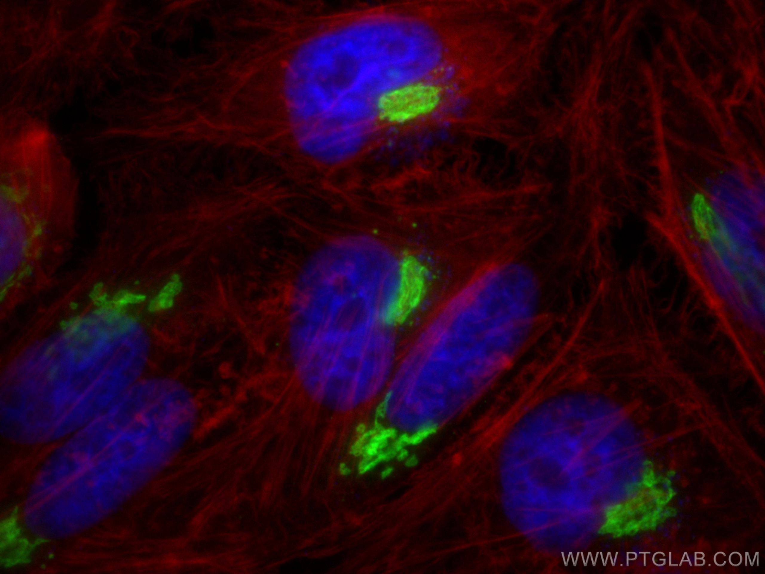 Immunofluorescence (IF) / fluorescent staining of HeLa cells using GALNT2 Polyclonal antibody (17441-1-AP)