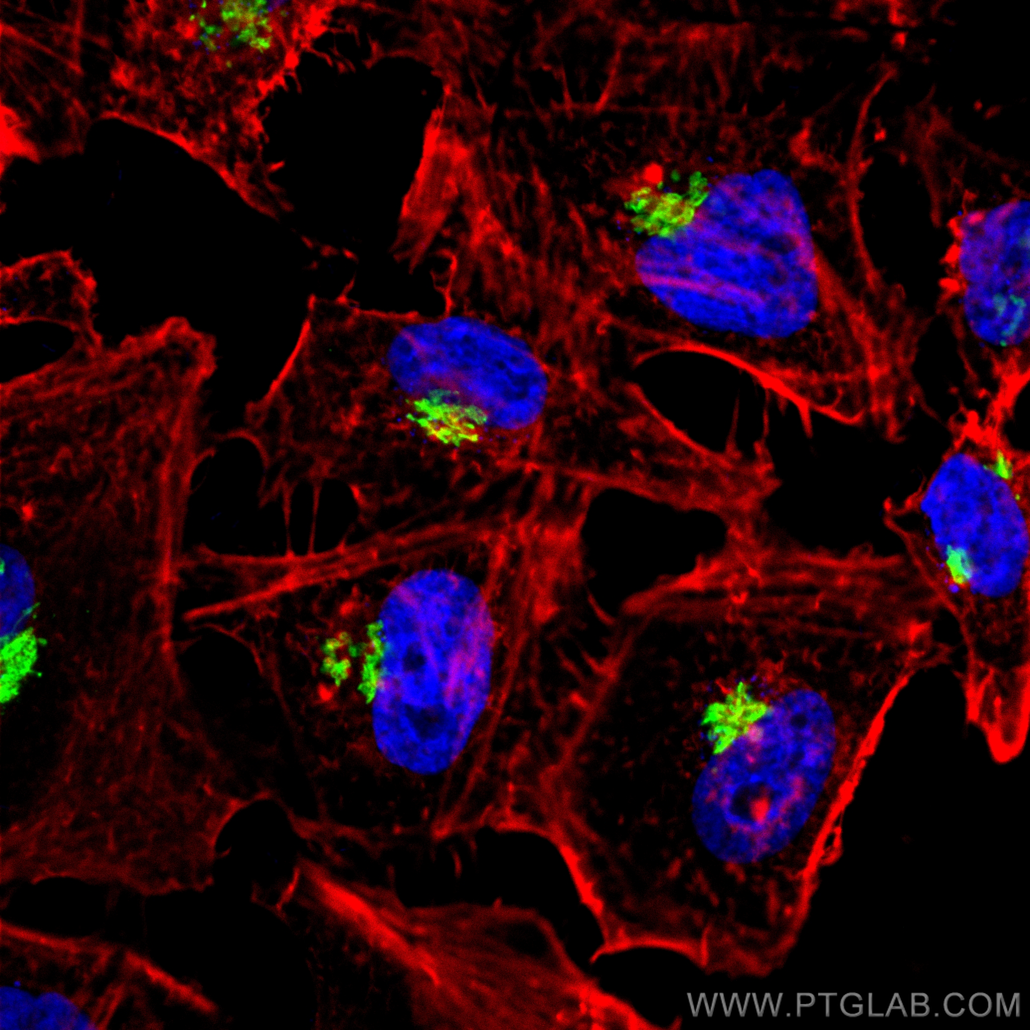 Immunofluorescence (IF) / fluorescent staining of HeLa cells using GALNT2 Polyclonal antibody (17441-1-AP)