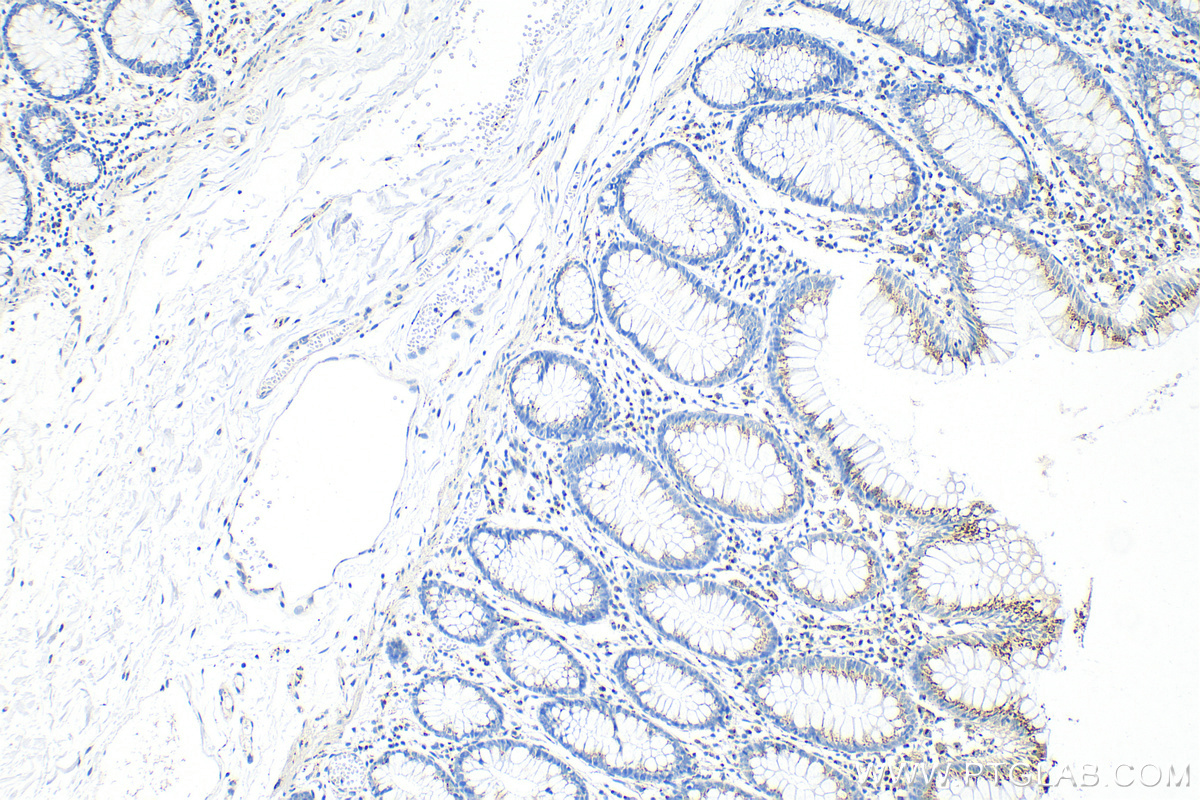 Immunohistochemistry (IHC) staining of human colon tissue using GALNT2 Polyclonal antibody (17441-1-AP)