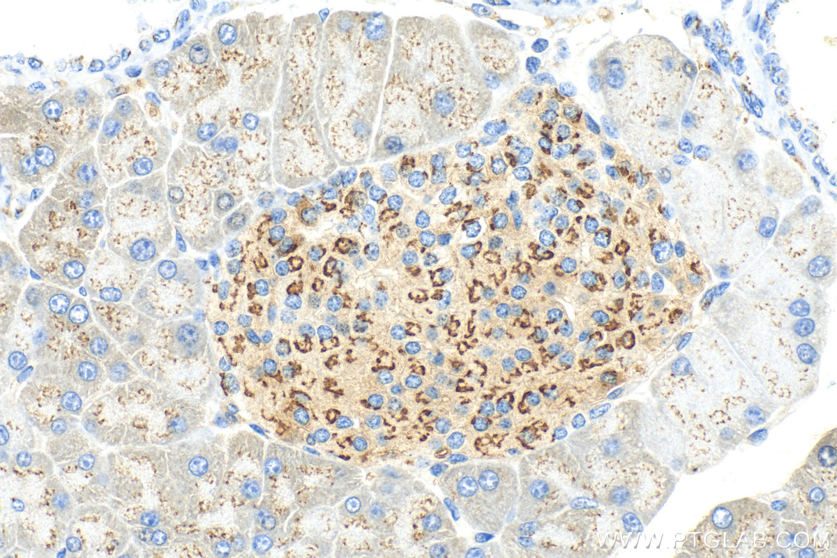 Immunohistochemistry (IHC) staining of mouse pancreas tissue using GALNT2 Polyclonal antibody (17441-1-AP)