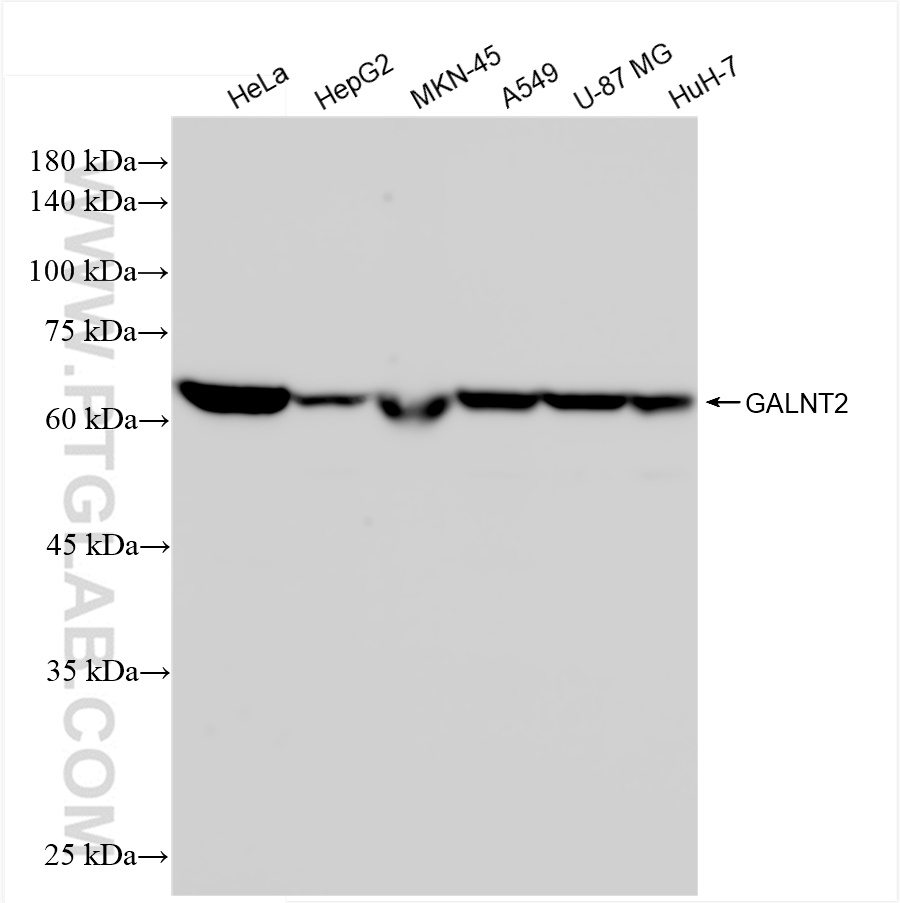 Western Blot (WB) analysis of various lysates using GALNT2 Recombinant antibody (83703-2-RR)