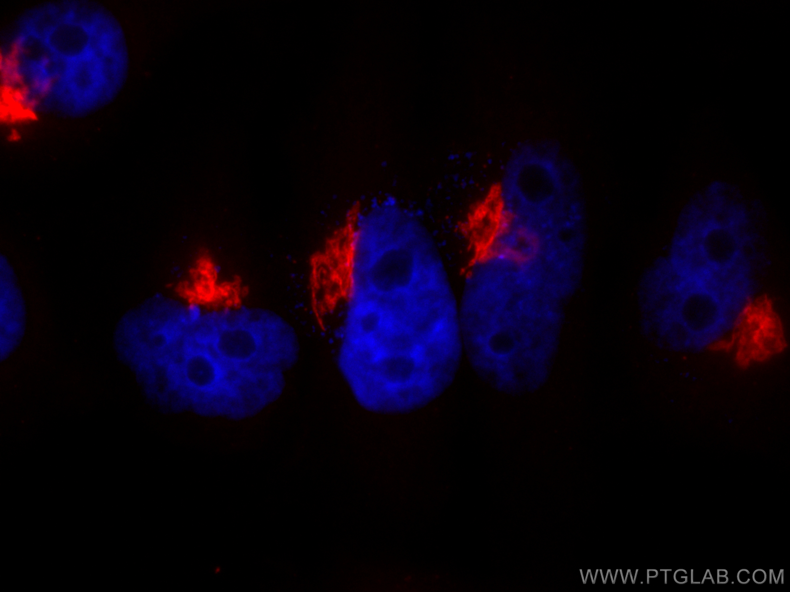 Immunofluorescence (IF) / fluorescent staining of HeLa cells using CoraLite® Plus 594-conjugated GALNT2 Polyclonal an (CL594-17441)