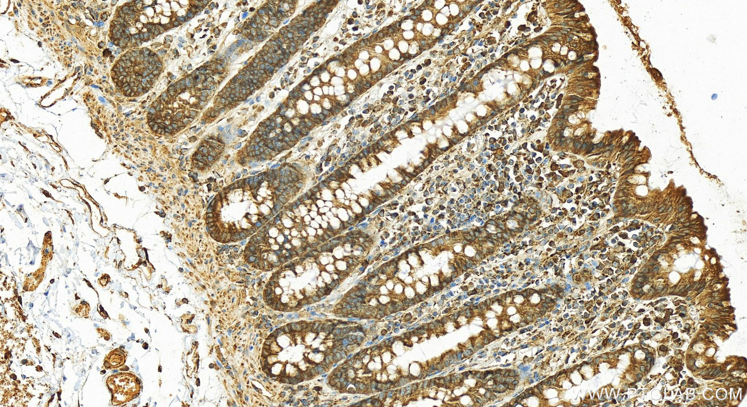 Immunohistochemistry (IHC) staining of human colon tissue using GANAB Polyclonal antibody (29183-1-AP)